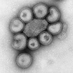 flu-virus-cell-infectious-magnify-scientific